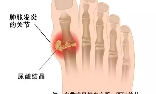糖尿病病人能吃营养粉吗-糖尿病病人能吃营养粉吗专区_全营养蛋白粉的功效与作用专区_全营养蛋白质粉糖尿病人能吃吗网